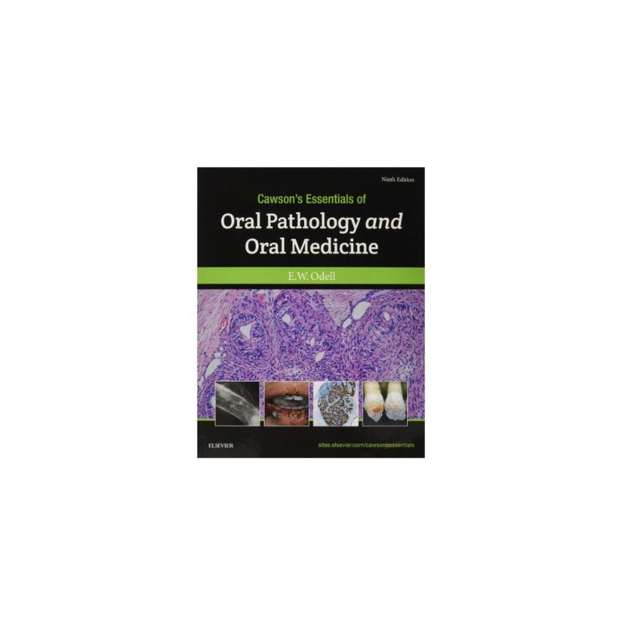 Cawson's Essentials of Oral Pathology And oral Medicine 9th Edition