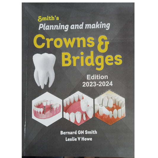 Smiths Planning and Making Crowns and Bridges 7th Edition