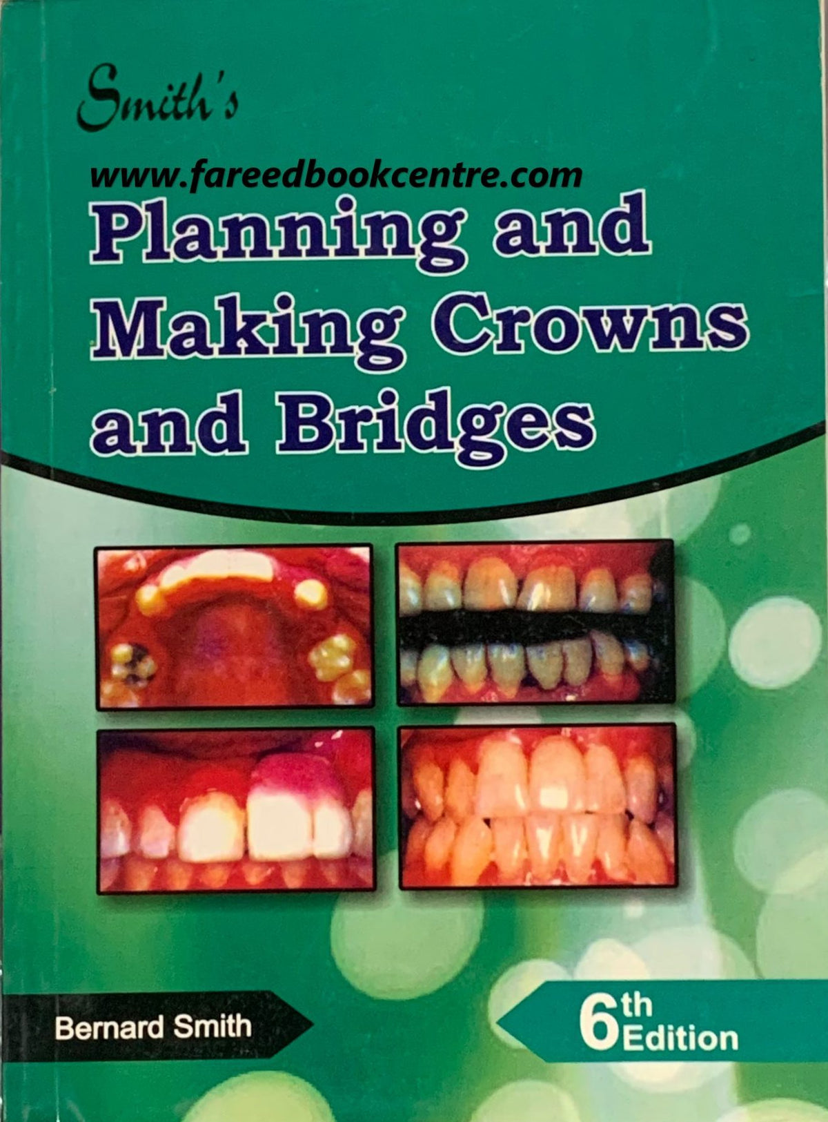 Smiths Planning and Making Crowns and Bridges 7th Edition