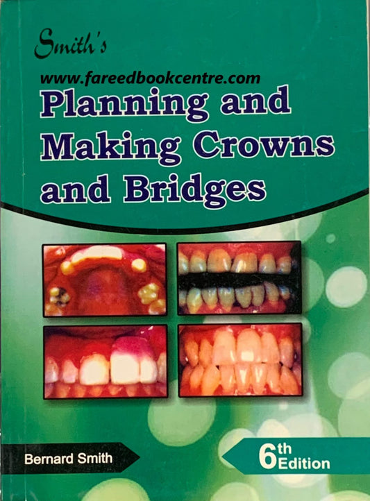 Smiths Planning and Making Crowns and Bridges 7th Edition